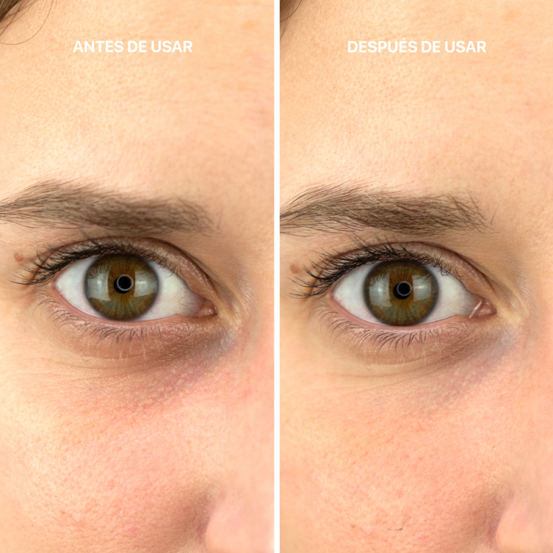 BOTULINUM EFFECT EYE CONTOUR